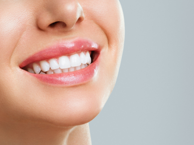 Unlock Your Dream Smile: Exploring Teeth Whitening and Cosmetic Dentistry Options
